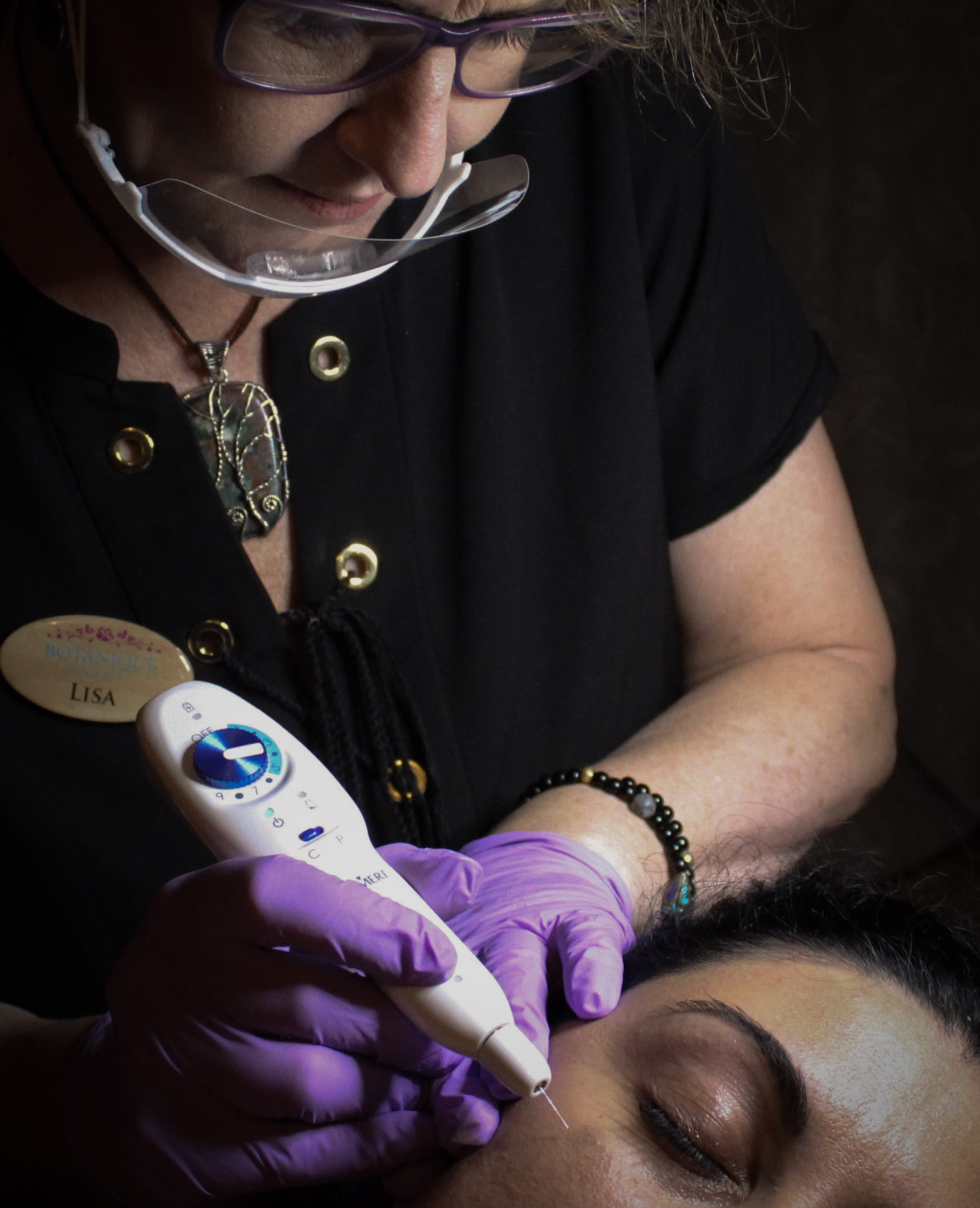 woman receiving nano-needling treatment